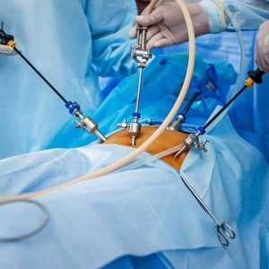 advanced laparoscopic surgeries