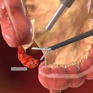 locating-grasping-appendix_807466-1494_11zon